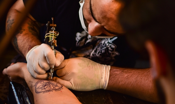 Ile kosztuje usunięcie tatuażu?