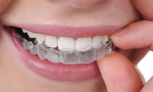 Aparat Ortodontyczny w każdym wieku?