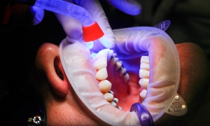 Aparaty ortodontyczne i implanty zębowe